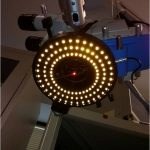 Refinements in Cataract Surger